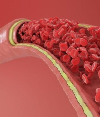 Sasia e madhe e proteinave përkeqëson arteriet
